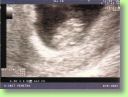 2006.09.14 echo2.jpg